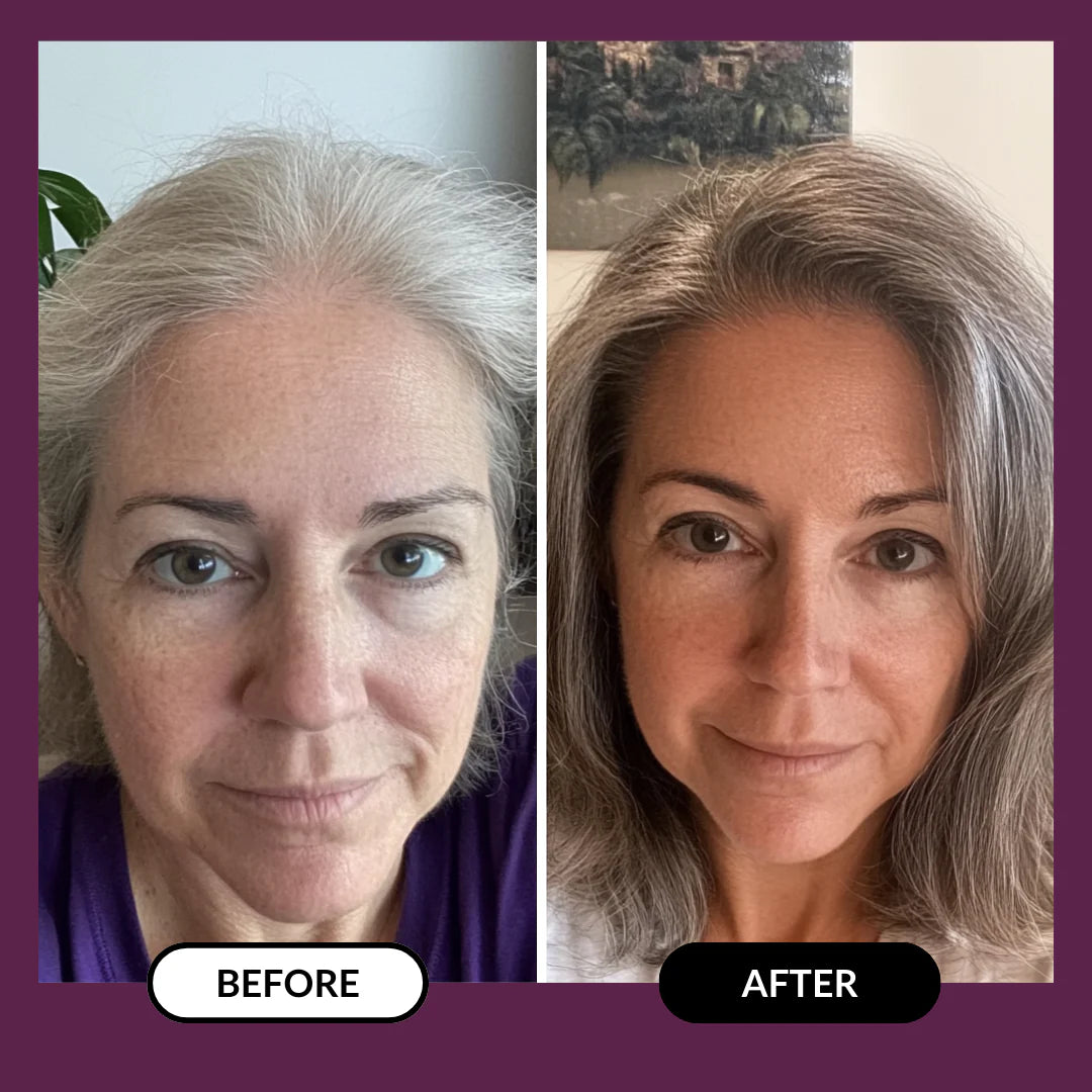 ThickHair - Hair Regrowth System