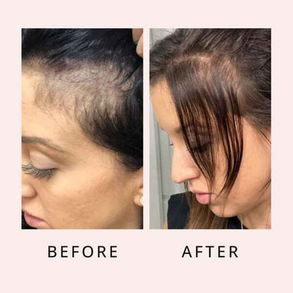 Luxury Hair Growth Serum